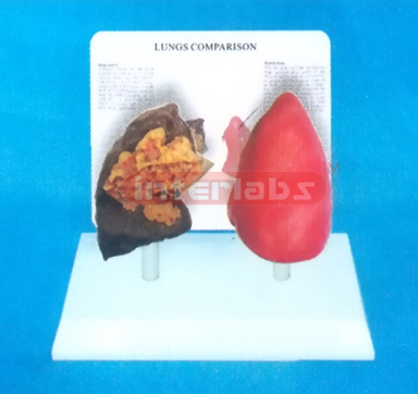 DESK-TYPE, LANGS MODEL FOR COMPARISION DEMONSTRATING HEALTHMAN THE SMOKING MAN WITH DESCRIPTION PLATE